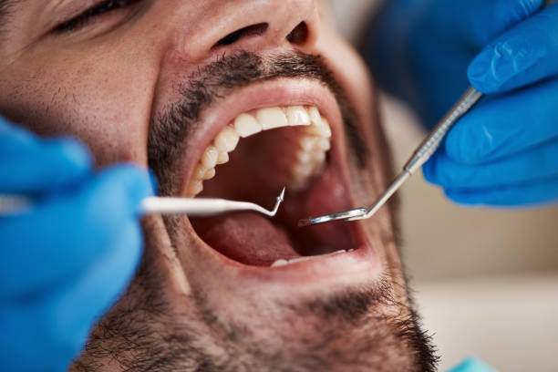 Best Emergency Treatment for Dental Infections or Abscesses in Washington Court House, OH