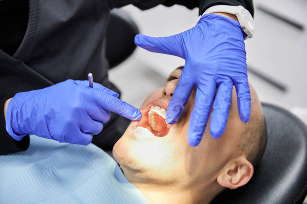 Best Emergency Wisdom Teeth Removal in Washington Court House, OH