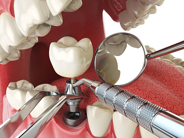 Best Pediatric Emergency Dentist in Washington Court House, OH