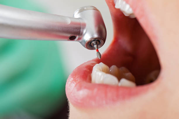Best Cosmetic Emergency Dentistry in Washington Court House, OH